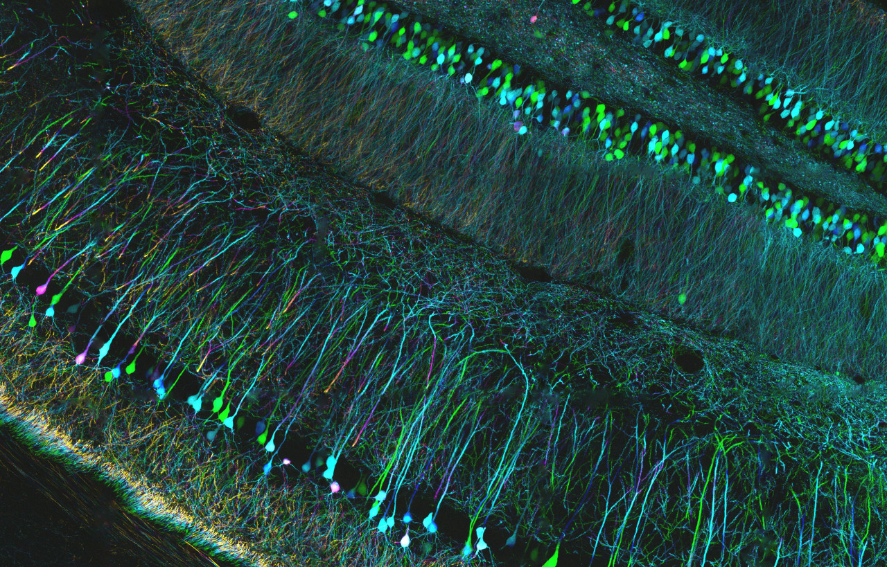 From ZEISS Microscopy, “Confocal microscopy of mouse brain, detail” “Depth coded projection (colour) image of mouse hippocampus sections of thy1-GFP line. Stained with GFP and imaged with ZEISS ELYRA PS.1 with LSM 780 confocal option. Tiling &amp; stitching with ZEN software generates hi-res confocal maps, make sure to download in full resolution and zoom in. Sample courtesy of Yi Zuo, Molecular, Cell and Developmental Biology (MCDB) Department, University of California Santa Cruz. www.zeiss.com/elyra”