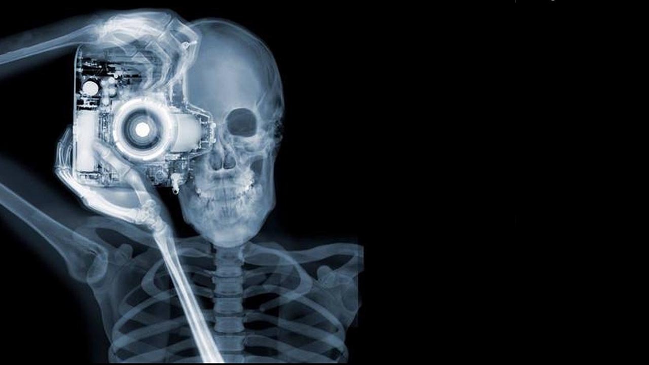 El artista y fotógrafo inglés Nick Veasey utiliza los rayos X, no está motivado por ningún fin científico, sólo observar la realidad a través de estas increíbles imágenes hechas con rayos X (Nick Veasey )Mirá toda la Fotogalería en HD